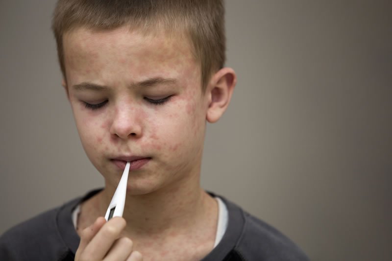 Pediatric Autoimmune Disorders